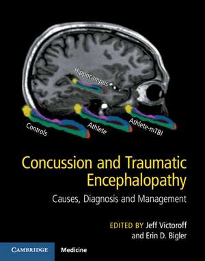 Concussion and Traumatic Encephalopathy: Causes, Diagnosis and Management de Jeff Victoroff