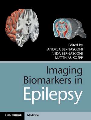 Imaging Biomarkers in Epilepsy de Andrea Bernasconi