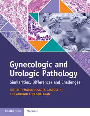 Gynecologic and Urologic Pathology: Similarities, Differences and Challenges de Maria Rosaria Raspollini