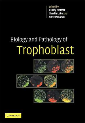 Biology and Pathology of Trophoblast de Ashley Moffett