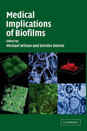 Medical Implications of Biofilms de Michael Wilson