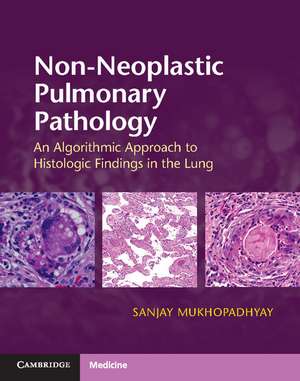 Non-Neoplastic Pulmonary Pathology with Online Resource: An Algorithmic Approach to Histologic Findings in the Lung de Sanjay Mukhopadhyay