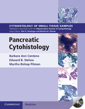 Pancreatic Cytohistology de Barbara Ann Centeno