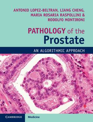 Pathology of the Prostate: An Algorithmic Approach de Antonio Lopez-Beltran