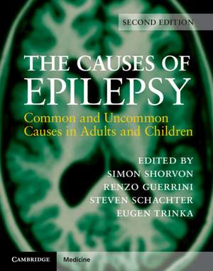 The Causes of Epilepsy: Common and Uncommon Causes in Adults and Children de Simon Shorvon