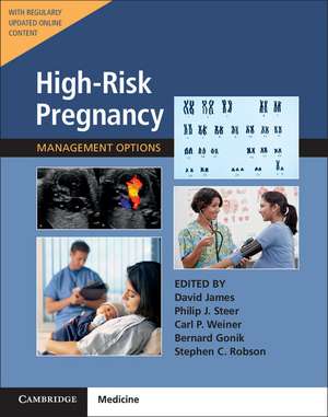 High-Risk Pregnancy with Online Resource: Management Options de David James