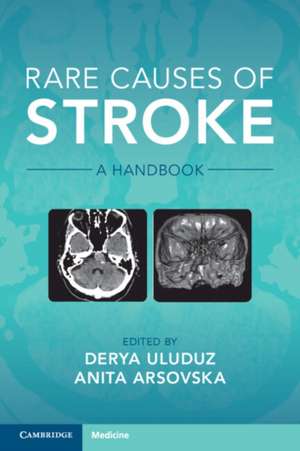 Rare Causes of Stroke: A Handbook de Derya Uluduz