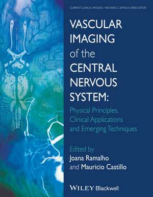 Vascular Imaging of the Central Nervous System – Physical Principles, Clinical Applications, and Emergency Techniques de J Ramalho