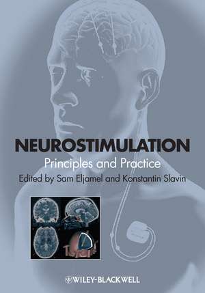 Neurostimulation – Principles and Practice de S Eljamel