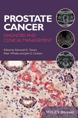 Prostate Cancer – Diagnosis and Clinical Management de AK Tewari