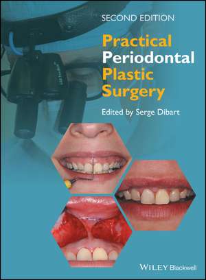 Practical Periodontal Plastic Surgery de Serge Dibart