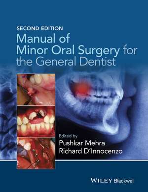 Manual of Minor Oral Surgery for the General Dentist 2e de P Mehra