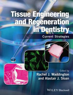 Tissue Engineering and Regeneration in Dentistry – Current Strategies de R Waddington