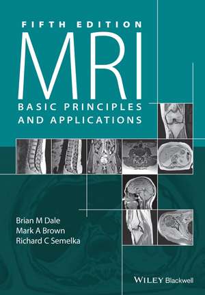 MRI Basic Principles and Applications, 5e de BM Dale