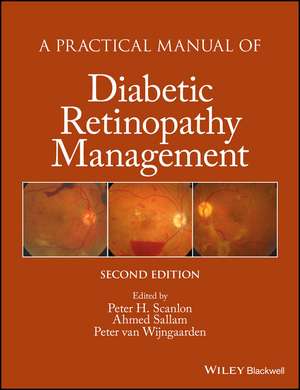 A Practical Manual of Diabetic Retinopathy Management 2e de P Scanlon