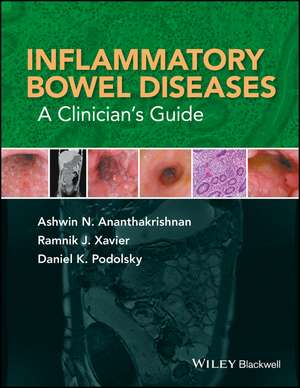 Inflammatory Bowel Diseases – A Clinician′s Guide de A Ananthakrishnan