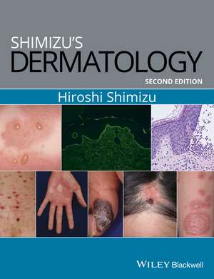 Shimizu′s Dermatology, 2e de H Shimizu