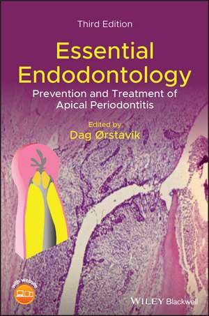 Essential Endodontology – Prevention and Treatment of Apical Periodontitis, 3rd Edition de D Orstavik