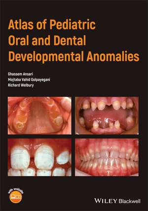 Atlas of Pediatric Oral and Dental Developmental Anomalies de Ghassem Ansari