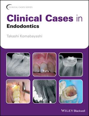 Clinical Cases in Endodontics de Takashi Komabayashi