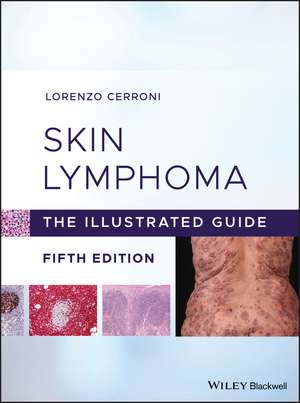 Skin Lymphoma – The Illustrated Guide de L Cerroni