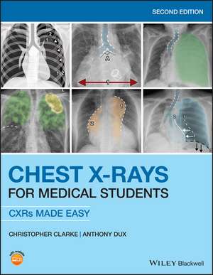 Chest X–rays for Medical Students – CXRs Made Easy 2nd Edition de C Clarke