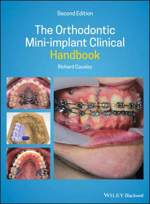 The Orthodontic Mini–implant Clinical Handbook 2nd Edition de R Cousley