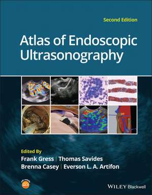 Atlas of Endoscopic Ultrasonography 2e de FG Gress