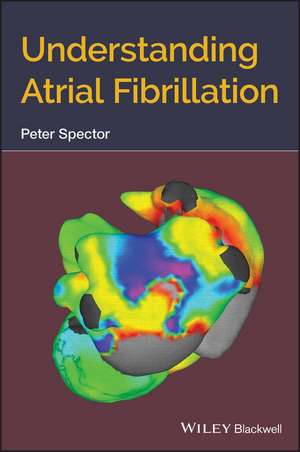 Understanding Atrial Fibrillation de P Spector