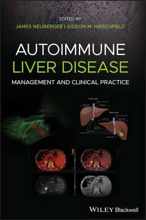 Autoimmune Liver Disease – Management and Clinical Practice de J Neuberger