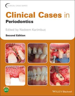 Clinical Cases in Periodontics 2e de N Karimbux