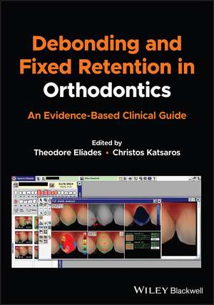 Debonding and Fixed Retention in Orthodontics – An Evidence–Based Clinical Guide de T Eliades