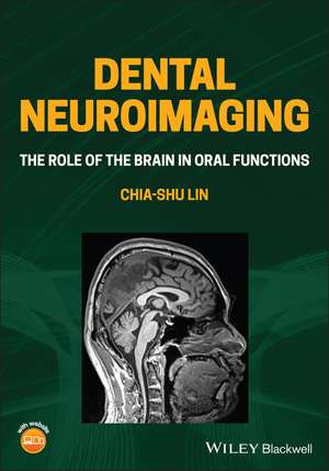 Dental Neuroimaging – The Role of the Brain in Oral Functions de CS Lin