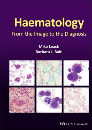 Haematology – From the Image to the Diagnosis de M Leach