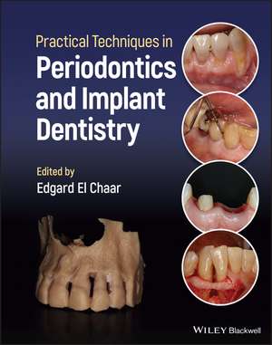 Practical Techniques in Periodontics and Implant Dentistry de E El Chaar