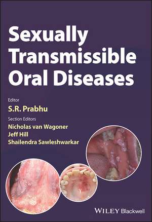 Sexually Transmissible Oral Diseases de SR Prabhu