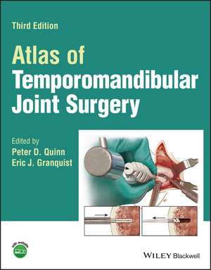 Atlas of Temporomandibular Joint Surgery, Third Ed ition de Quinn