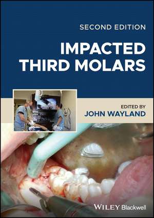 Impacted Third Molars de J Wayland