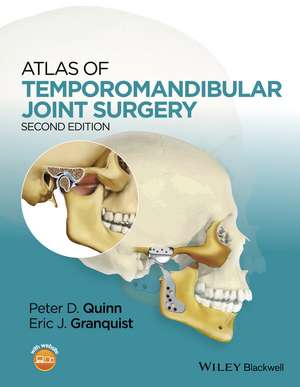 Atlas of Temporomandibular Joint Surgery de Peter D. Quinn