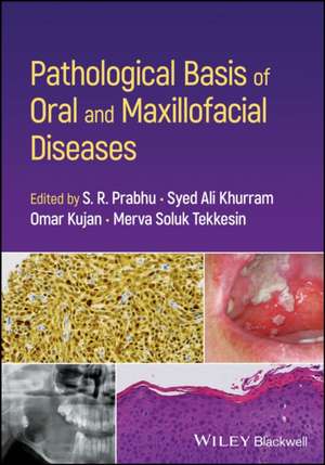 Pathological Basis of Oral and Maxillofacial Diseases de S R Prabhu