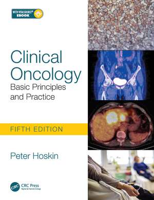 Clinical Oncology: Basic Principles and Practice de Peter Hoskin