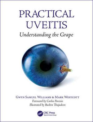 Practical Uveitis: Understanding the Grape de Gwyn Samuel Williams