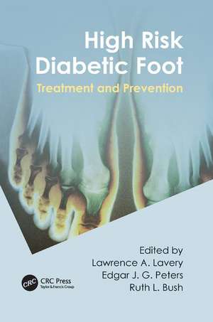 High Risk Diabetic Foot: Treatment and Prevention de Lawrence A. Lavery