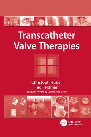 Transcatheter Valve Therapies de Christoph Huber