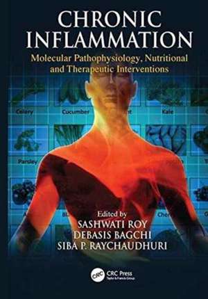 Chronic Inflammation: Molecular Pathophysiology, Nutritional and Therapeutic Interventions de Sashwati Roy