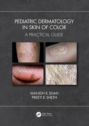 Pediatric Dermatology in Skin of Color: A Practical Guide de Manish K Shah