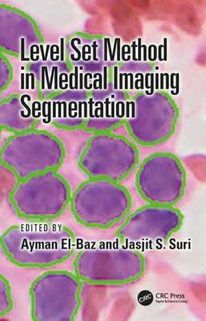 Level Set Method in Medical Imaging Segmentation de Ayman El-Baz