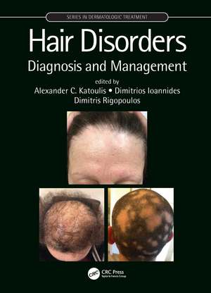 Hair Disorders: Diagnosis and Management de Alexander C. Katoulis