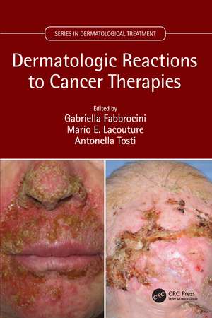 Dermatologic Reactions to Cancer Therapies de Gabriella Fabbrocini