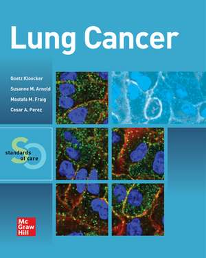 Lung Cancer: Standards of Care de Goetz Kloecker